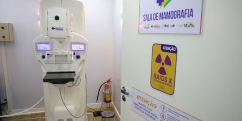 Homens costumam descobrir câncer de mama em estágio mais avançado
