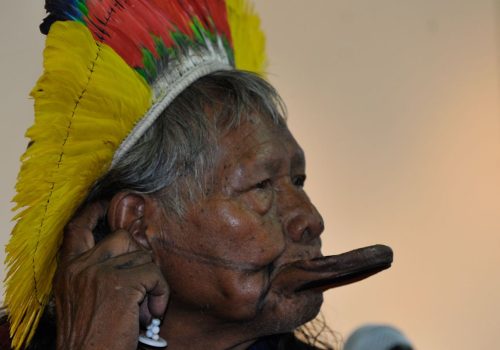 Cacique Raoni apresenta boa evolução clínica e vai para enfermaria