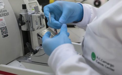 Cura de câncer de próstata pode chegar a até 98% 