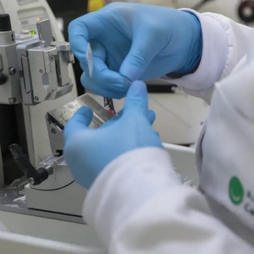 Cura de câncer de próstata pode chegar a até 98% 