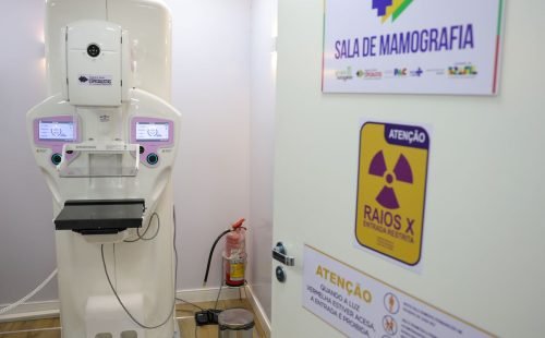 Homens costumam descobrir câncer de mama em estágio mais avançado
