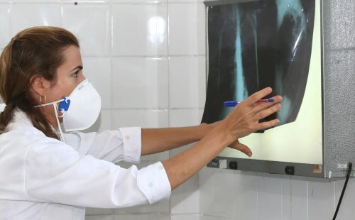 OMS recomenda testes de diagnóstico rápido para erradicar tuberculose